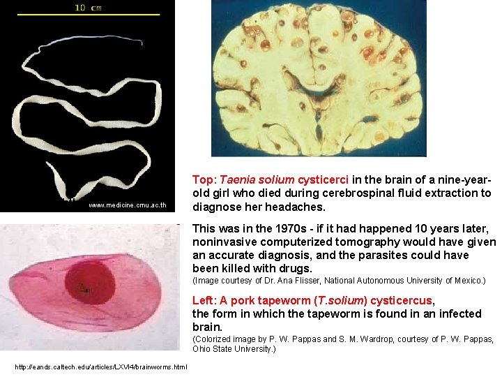 http: //www. medicine. cmu. ac. th Top: Taenia solium cysticerci in the brain of