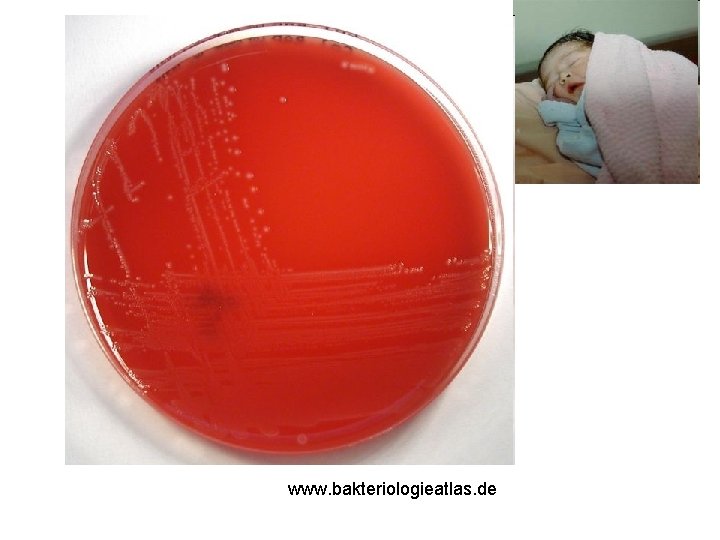 www. bakteriologieatlas. de 