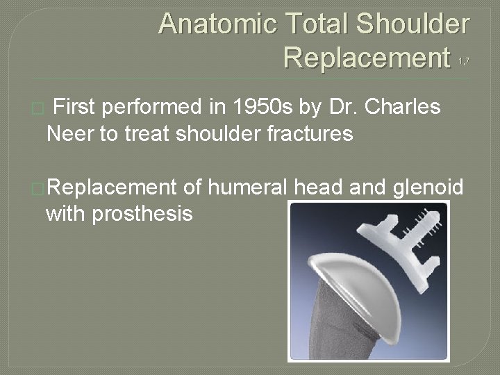 Anatomic Total Shoulder Replacement 1, 7 � First performed in 1950 s by Dr.