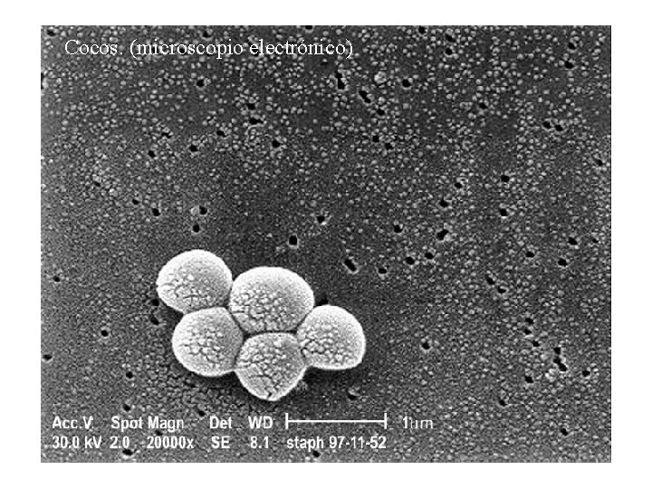 Cocos. (microscopio electrónico) 