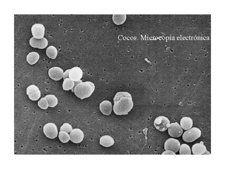 Cocos. Microcopía electrónica 