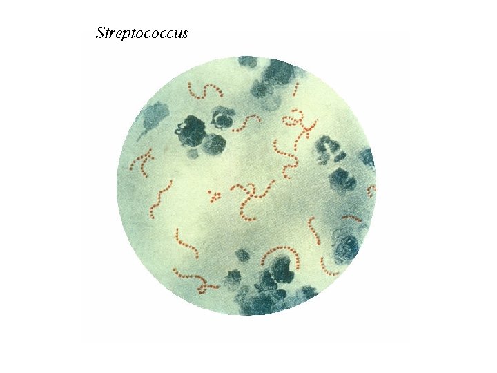 Streptococcus 
