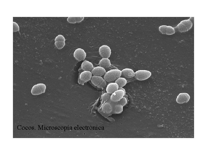 Cocos. Microscopía electrónica 