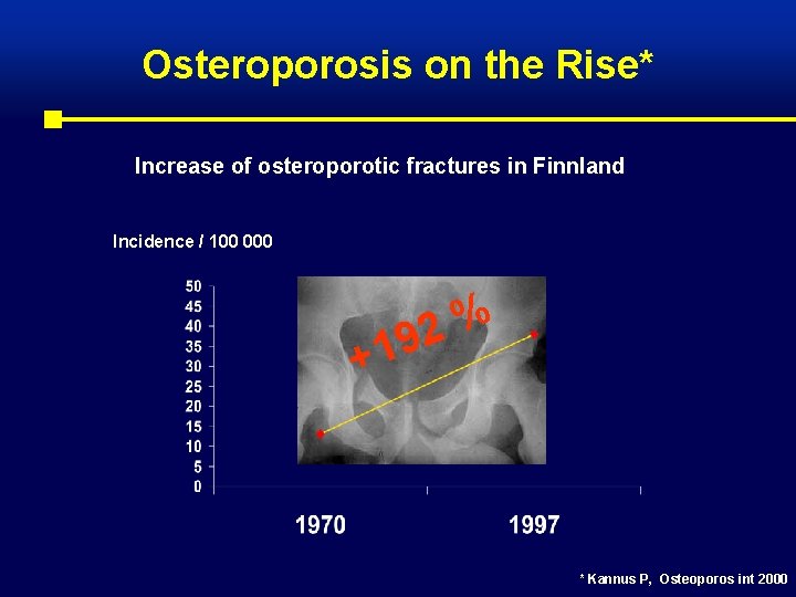 Osteroporosis on the Rise* Increase of osteroporotic fractures in Finnland Incidence / 100 000
