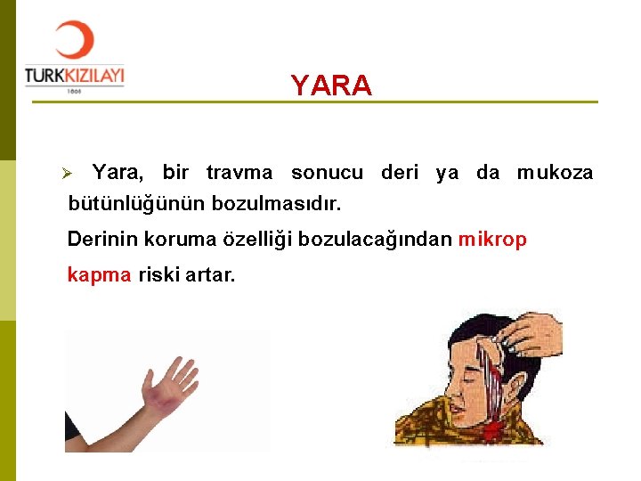 YARA Yara, bir travma sonucu deri ya da mukoza bütünlüğünün bozulmasıdır. Ø Derinin koruma