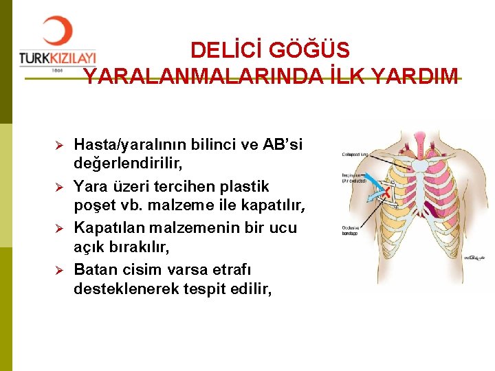 DELİCİ GÖĞÜS YARALANMALARINDA İLK YARDIM Ø Ø Hasta/yaralının bilinci ve AB’si değerlendirilir, Yara üzeri