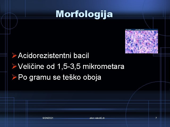 Morfologija Ø Acidorezistentni bacil Ø Veličine od 1, 5 -3, 5 mikrometara Ø Po