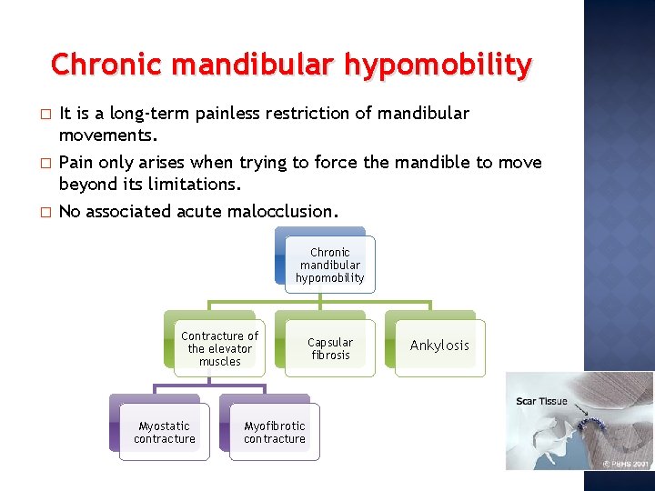 Chronic mandibular hypomobility � � � It is a long-term painless restriction of mandibular