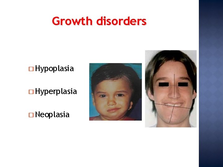 Growth disorders � Hypoplasia � Hyperplasia � Neoplasia 