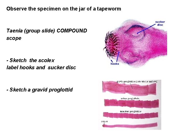 Observe the specimen on the jar of a tapeworm Taenia (group slide) COMPOUND scope