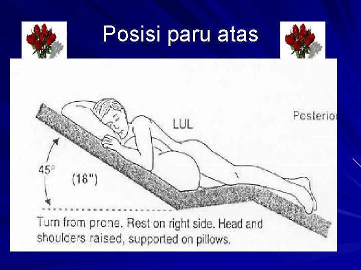 Posisi paru atas 