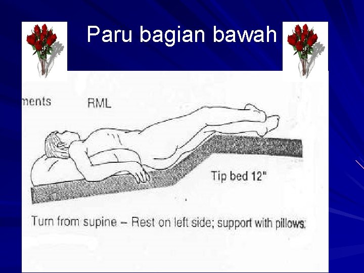 Paru bagian bawah 