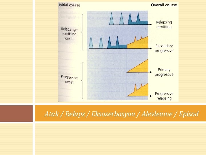 Atak / Relaps / Eksaserbasyon / Alevlenme / Episod 