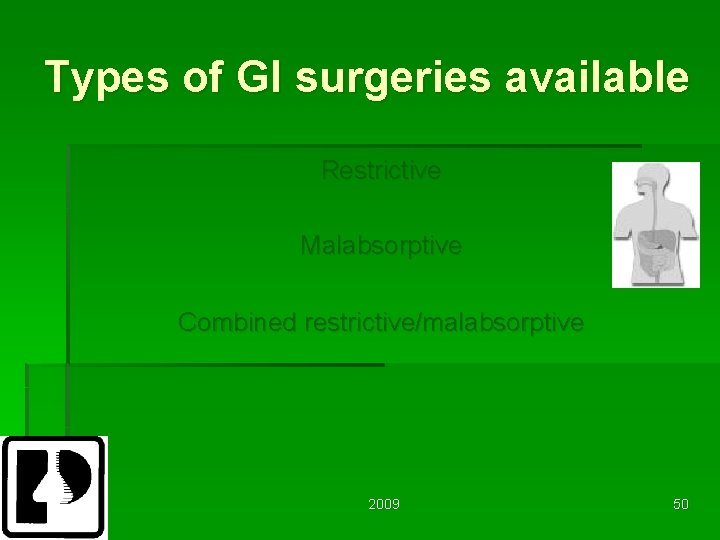 Types of GI surgeries available Restrictive Malabsorptive Combined restrictive/malabsorptive 2009 50 