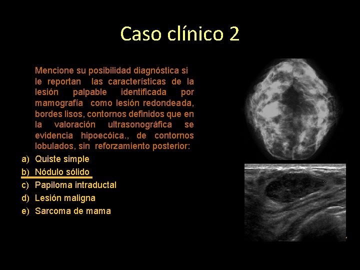 Caso clínico 2 a) b) c) d) e) Mencione su posibilidad diagnóstica si le