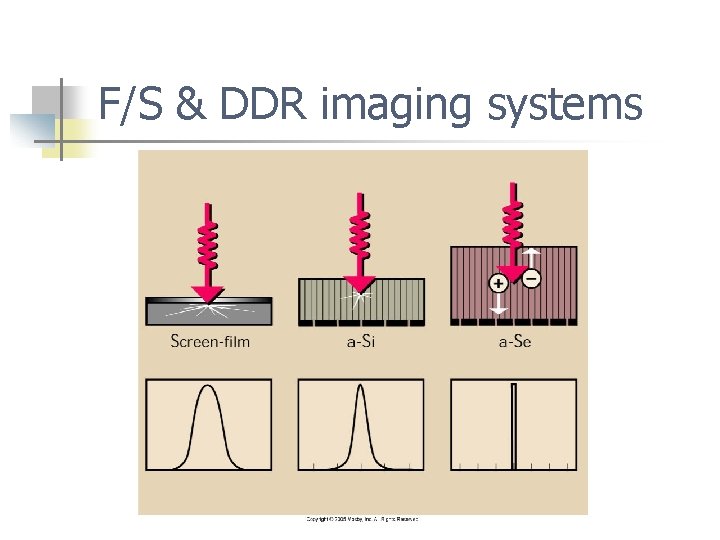 F/S & DDR imaging systems 