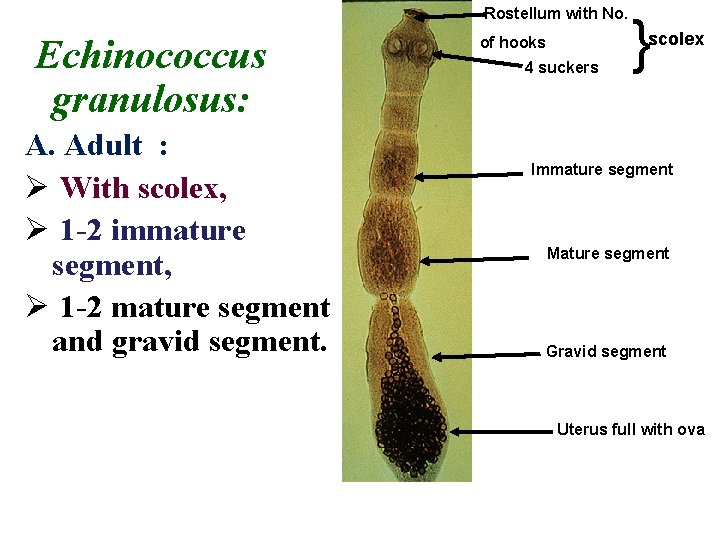 Rostellum with No. Echinococcus granulosus: A. Adult : Ø With scolex, Ø 1 -2