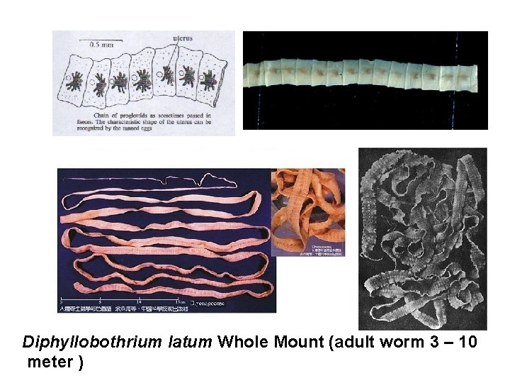 Diphyllobothrium latum Whole Mount (adult worm 3 – 10 meter ) 