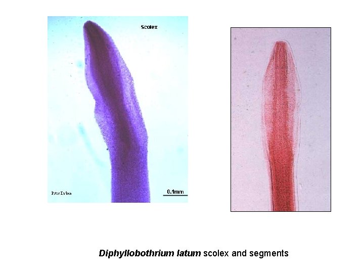 Diphyllobothrium latum scolex and segments 