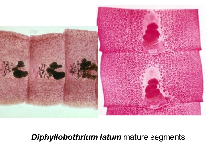 Diphyllobothrium latum mature segments 