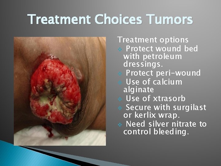 Treatment Choices Tumors Treatment options v Protect wound bed with petroleum dressings. v Protect