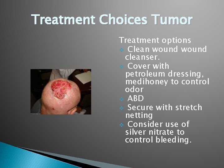 Treatment Choices Tumor Treatment options v Clean wound cleanser. v Cover with petroleum dressing,