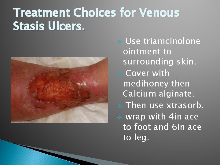 Treatment Choices for Venous Stasis Ulcers. Use triamcinolone ointment to surrounding skin. v Cover