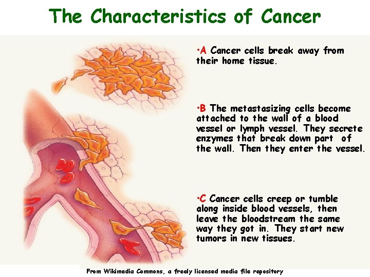 The Characteristics of Cancer • A Cancer cells break away from their home tissue.