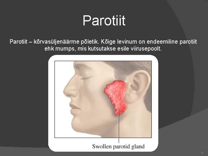 Parotiit – kõrvasüljenäärme põletik. Kõige levinum on endeemiline parotiit ehk mumps, mis kutsutakse esile