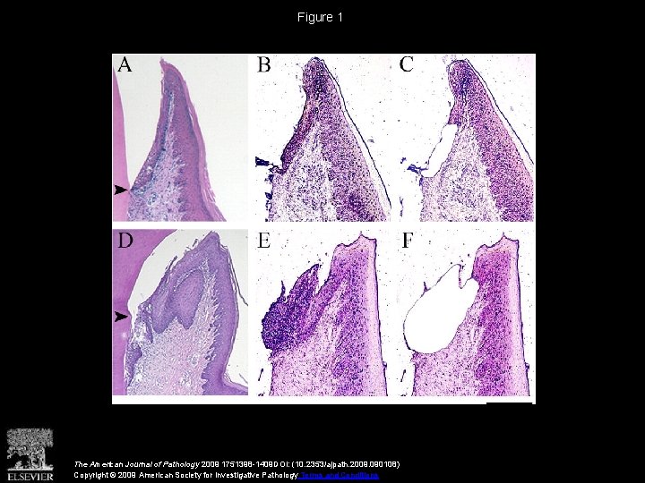 Figure 1 The American Journal of Pathology 2009 1751398 -1409 DOI: (10. 2353/ajpath. 2009.