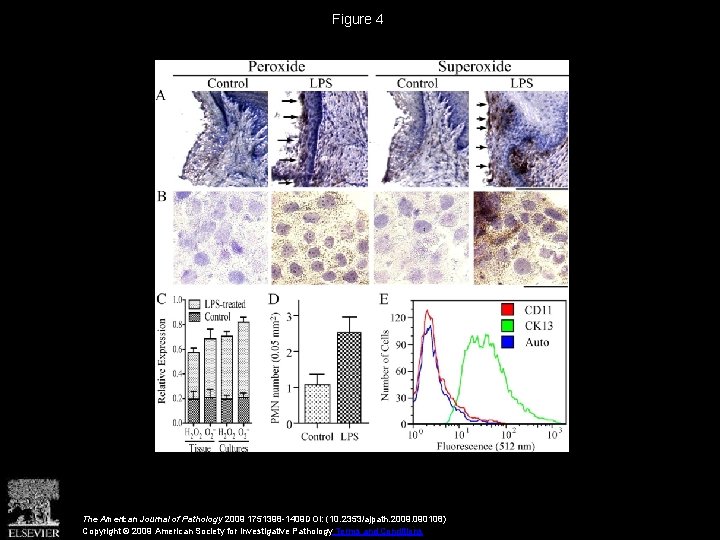 Figure 4 The American Journal of Pathology 2009 1751398 -1409 DOI: (10. 2353/ajpath. 2009.