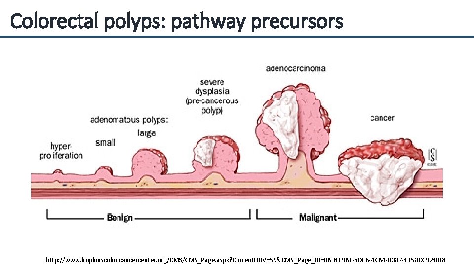 Colorectal polyps: pathway precursors http: //www. hopkinscoloncancercenter. org/CMS_Page. aspx? Current. UDV=59&CMS_Page_ID=0 B 34 E
