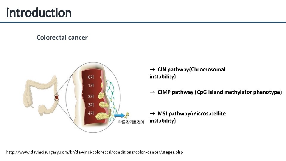 Introduction Colorectal cancer → CIN pathway(Chromosomal instability) → CIMP pathway (Cp. G island methylator
