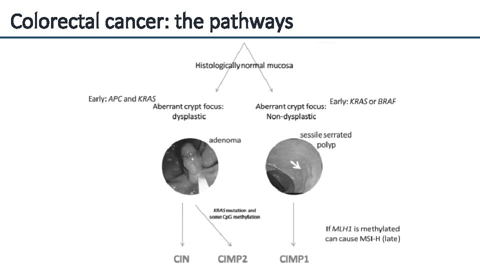 Colorectal cancer: the pathways 