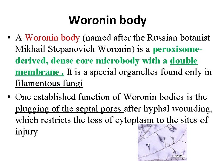 Woronin body • A Woronin body (named after the Russian botanist Mikhail Stepanovich Woronin)