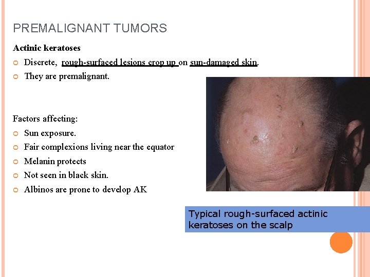PREMALIGNANT TUMORS Actinic keratoses Discrete, rough-surfaced lesions crop up on sun-damaged skin. They are