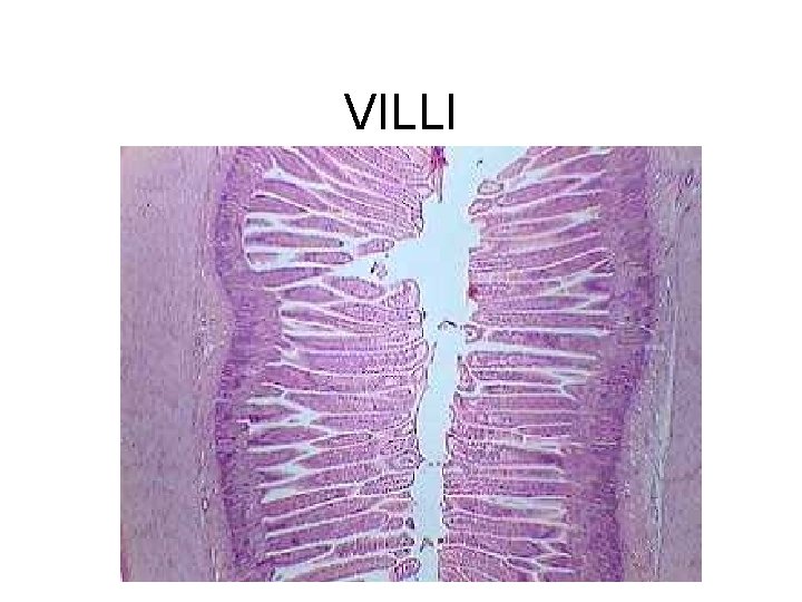 VILLI VILLI