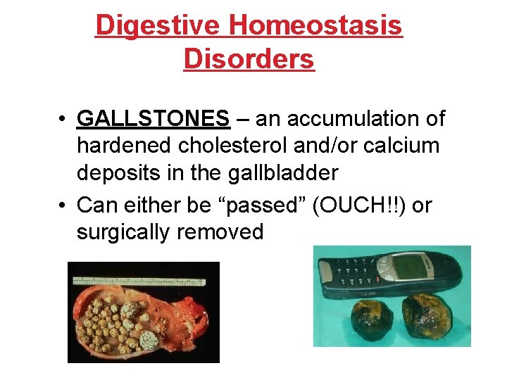 Digestive Homeostasis Disorders • GALLSTONES – an accumulation of hardened cholesterol and/or calcium deposits Digestive Homeostasis Disorders • GALLSTONES – an accumulation of hardened cholesterol and/or calcium deposits