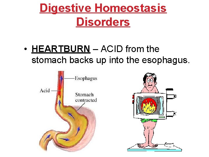 Digestive Homeostasis Disorders • HEARTBURN – ACID from the stomach backs up into the Digestive Homeostasis Disorders • HEARTBURN – ACID from the stomach backs up into the