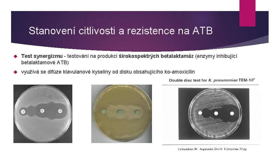 Stanovení citlivosti a rezistence na ATB Test synergizmu - testování na produkci širokospektrých betalaktamáz