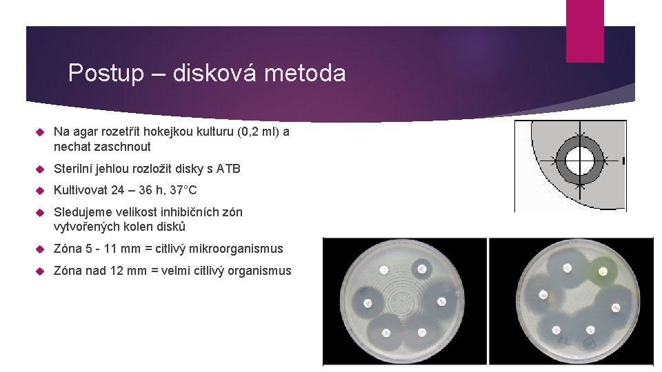 Postup – disková metoda Na agar rozetřít hokejkou kulturu (0, 2 ml) a nechat