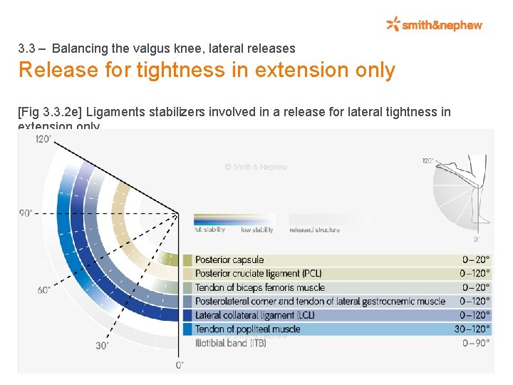 3. 3 – Balancing the valgus knee, lateral releases Release for tightness in extension