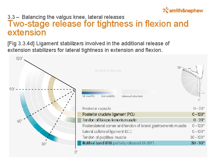 3. 3 – Balancing the valgus knee, lateral releases Two-stage release for tightness in