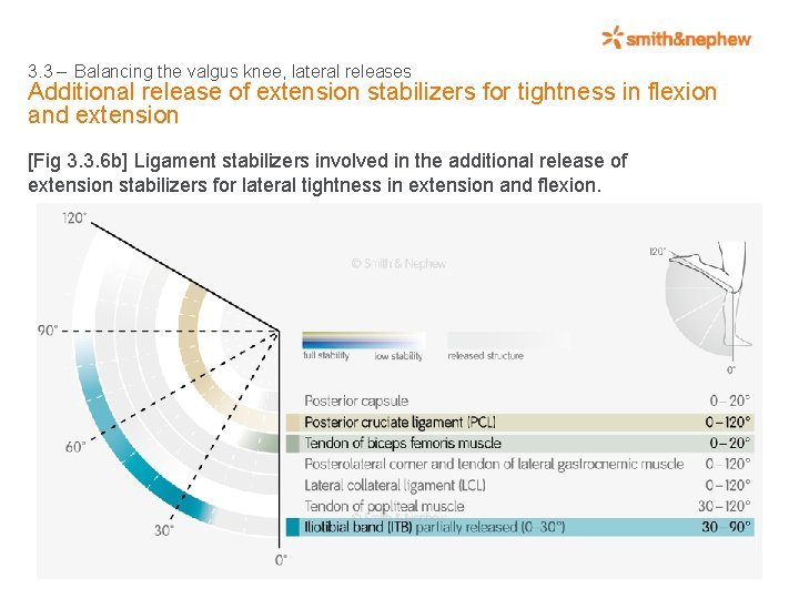 3. 3 – Balancing the valgus knee, lateral releases Additional release of extension stabilizers