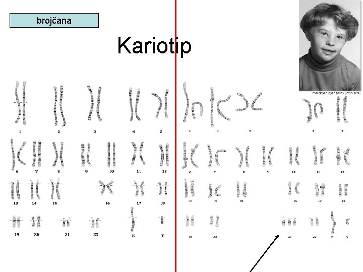 brojčana Kariotip brojčana Kariotip