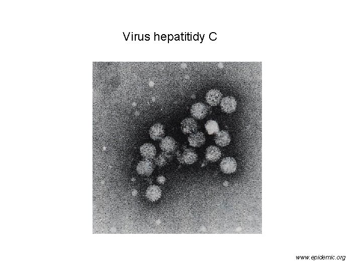 Virus hepatitidy C www. epidemic. org 