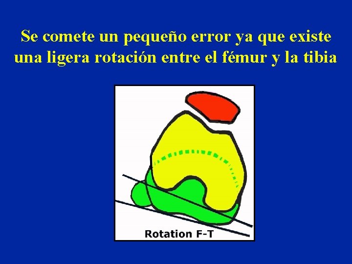 Se comete un pequeño error ya que existe una ligera rotación entre el fémur