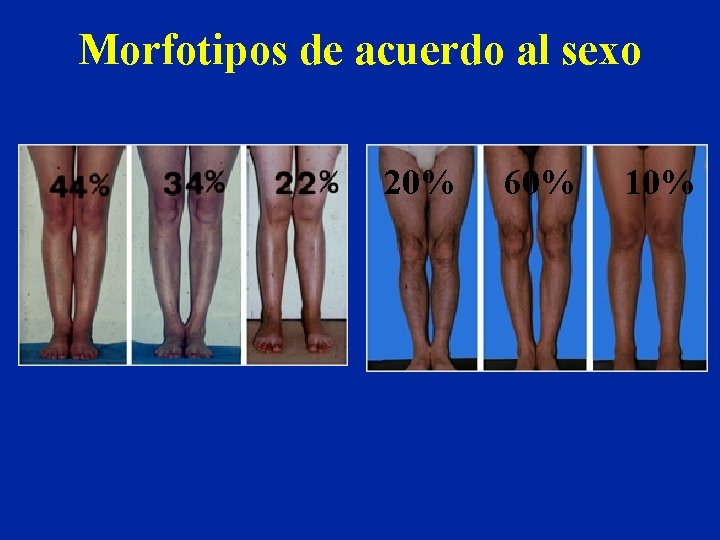 Morfotipos de acuerdo al sexo 20% 60% 10% 