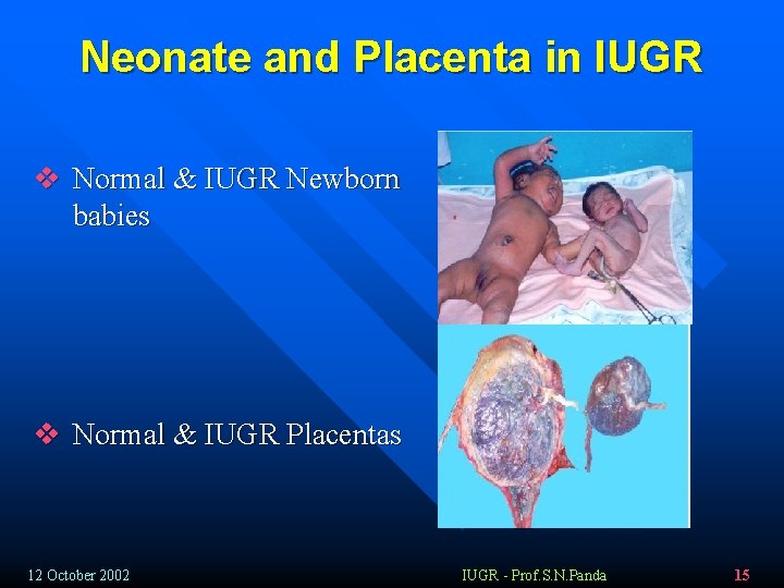 Neonate and Placenta in IUGR v Normal & IUGR Newborn babies v Normal &