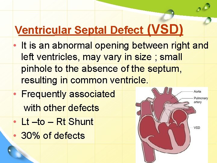 Ventricular Septal Defect (VSD) • It is an abnormal opening between right and left